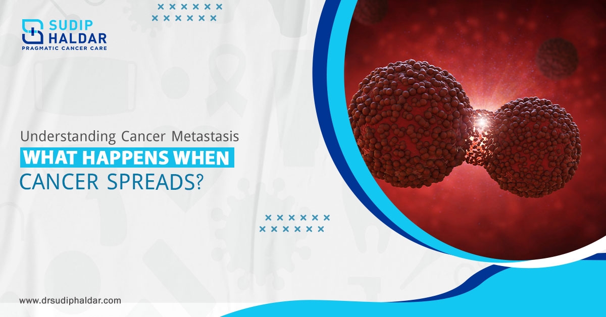 Oncology in Siliguri