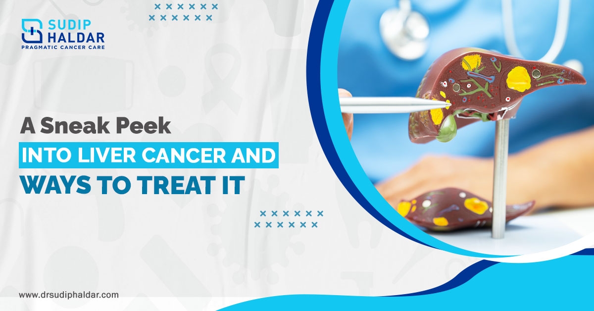 Oncology in Siliguri