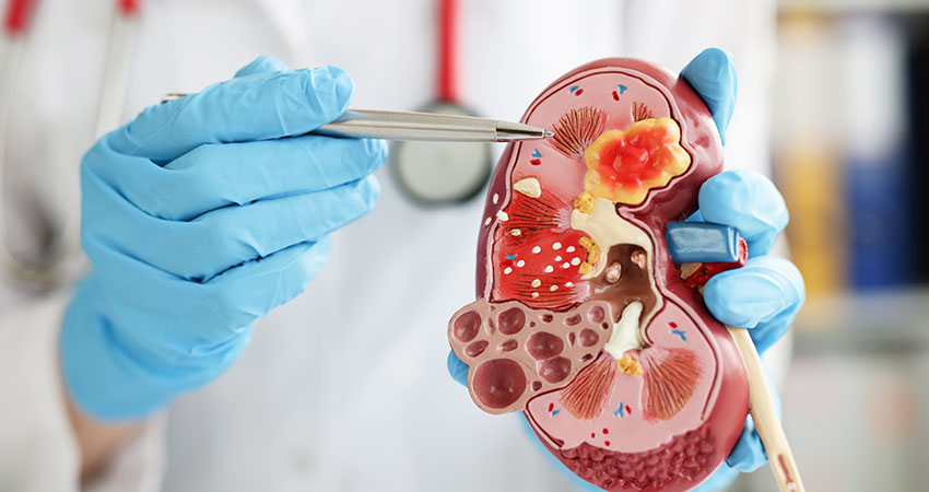 Urological & Gynaecological Malignancies